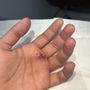 Clovis Urgent Care
