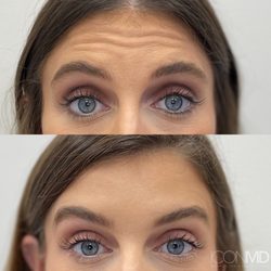 Icon MD Medical Spa + Laser Center - Davie