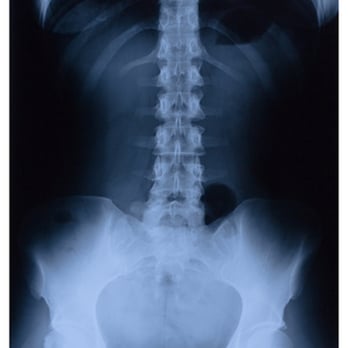 Tomlinson Chiropractic - Chiropractors Near Me - Kansas City, Missouri Tomlinson Chiropractic - Chiropractors Near Me - Kansas City, Missouri