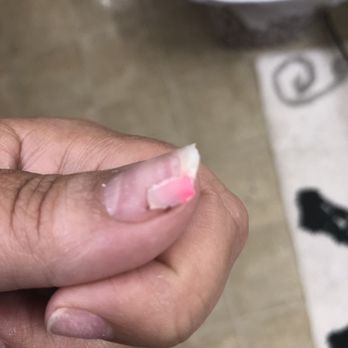 Gossip & Co Nail Spa - View from the top of the nail she partially ripped off. - Waxing Near Me - Cypress, Texas Gossip & Co Nail Spa - View from the top of the nail she partially ripped off. - Waxing Near Me - Cypress, Texas