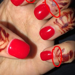 Tiffany Nails - This was right after, it got worse as the days went by.
