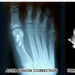 Foot & Ankle Specialists Of Iowa