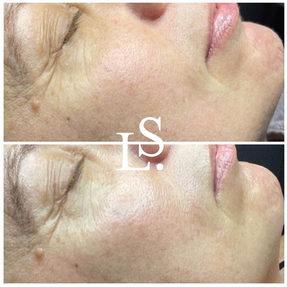 Lisa Sean Advanced Skin Care Logo