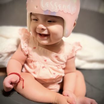 عدم ثبات خوذة علاج الرأس المسطح فوق الرأس