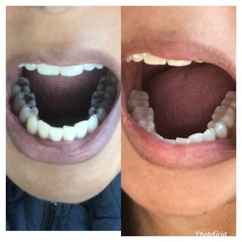 Granada Dental - General Dentistry Near Me - Livermore, California Granada Dental - General Dentistry Near Me - Livermore, California