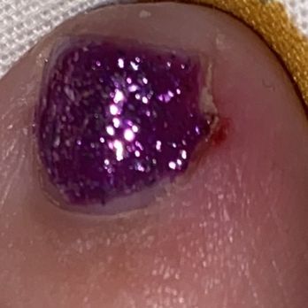 Forever Polished Nail Bar - The worst cut. - Nail Salons Near Me - Buda, Texas