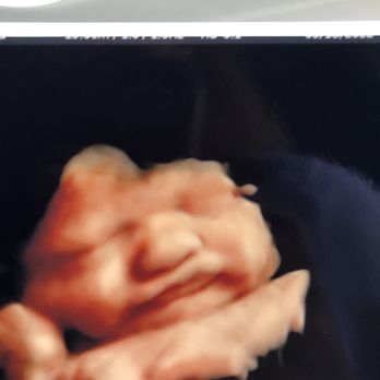 Heritage Baby View - Ultrasound photos - Diagnostic Imaging Near Me - Conway, South Carolina Heritage Baby View - Ultrasound photos - Diagnostic Imaging Near Me - Conway, South Carolina