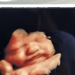Heritage Baby View - Ultrasound photos
