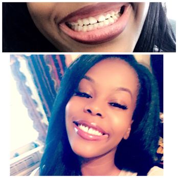 NYC Smile Spa - Cosmetic Dentists Near Me - New York, New York NYC Smile Spa - Cosmetic Dentists Near Me - New York, New York