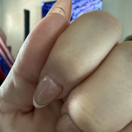 Another nail already to peel off. Another nail already to peel off.