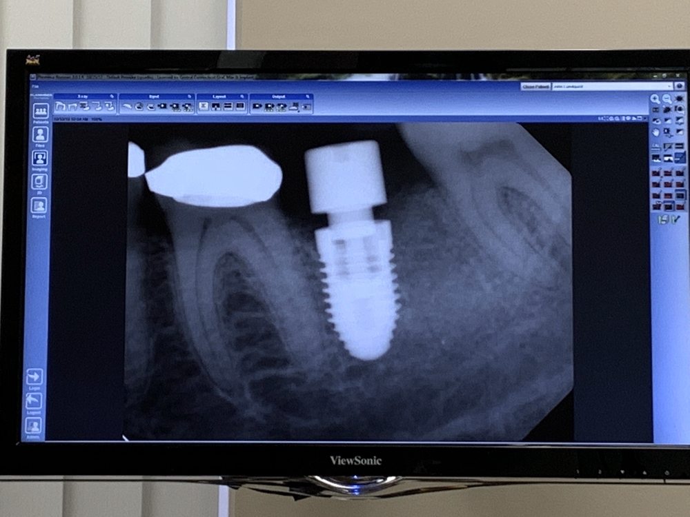 CENTRAL CONNECTICUT ORAL MAXILLOFACIAL & IMPLANT SURGERY 17 Photos