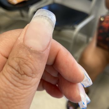 crackhead lights cigarette with thumb Every Drug Slang Term You Need to Know 12 Signs Someone Is Hiding