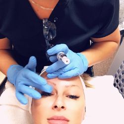Dream Lash Studio - Microneedeling