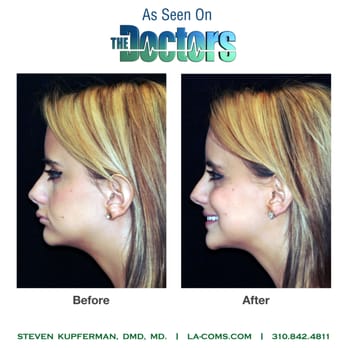 Steven B. Kupferman, DMD, MD - Oral Surgeons Near Me - Los Angeles, California Steven B. Kupferman, DMD, MD - Oral Surgeons Near Me - Los Angeles, California