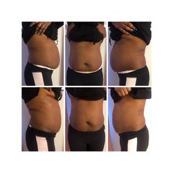 Natural Beauty Aesthetics - 1 session !