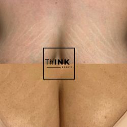 Think Beauty