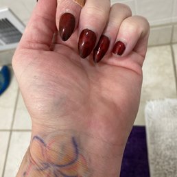 1 week pinky nail broke. 1 week pinky nail broke.