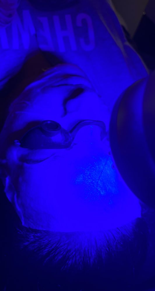 LASER AWAY BY RITA Request an Appointment 3578 15 Mile Rd, Sterling