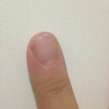 BinBin's Nails - painfully cut cuticle - Nail Salons Near Me - Astoria, New York BinBin's Nails - painfully cut cuticle - Nail Salons Near Me - Astoria, New York