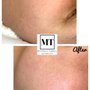 Photo of Michaela Tidball Esthetics
