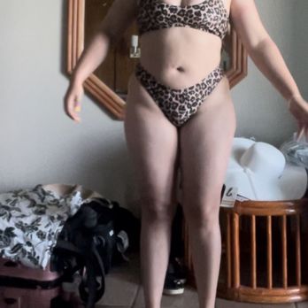 Norcal Liposculpture - Before - Cosmetic Surgeons Near Me - Roseville, California