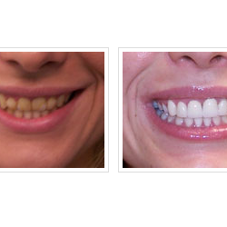 Empire Dental Group of New Jersey - Cosmetic Dentistry