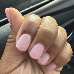UV Nail & Spa - Blood under nail