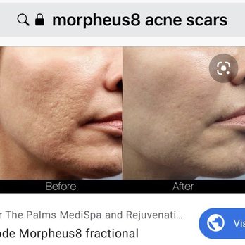 Nv'd Body Spa - Skin texture results - Day Spas Near Me - Las Vegas, Nevada Nv'd Body Spa - Skin texture results - Day Spas Near Me - Las Vegas, Nevada