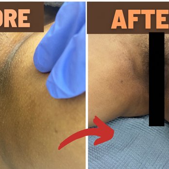 Vida Spa - Intimate bleaching - Medical Spas Near Me - New York, New York