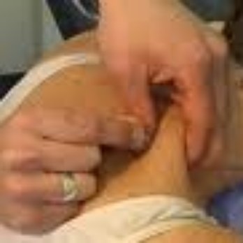 Kitsilano Physiotherapy Clinic - IMS - Physical Therapy Near Me - Vancouver, British Columbia Kitsilano Physiotherapy Clinic - IMS - Physical Therapy Near Me - Vancouver, British Columbia
