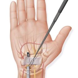 Colorado Center of Orthopaedic Excellence