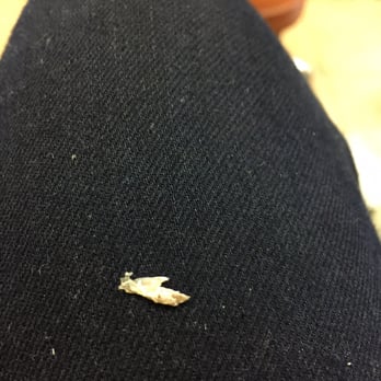 Ultra Nail Studio - Ingrown toenail part removed by the fab tech here!! - Nail Salons Near Me - Lansdowne, Pennsylvania