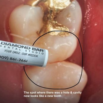 Diamond Bar Dental Studio - Cosmetic Dentists Near Me - Diamond Bar, California