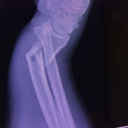 Bone & Joint Specialists
