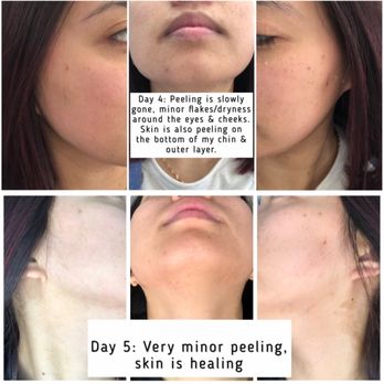 Lindy’s Skin Studio - Skin Care Near Me