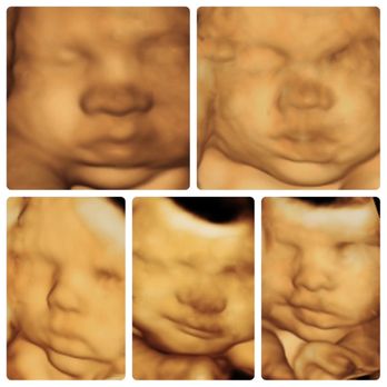 ShoMe Prenatal Imaging - Diagnostic Imaging Near Me - Pensacola, Florida ShoMe Prenatal Imaging - Diagnostic Imaging Near Me - Pensacola, Florida