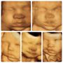 Photo of ShoMe Prenatal Imaging