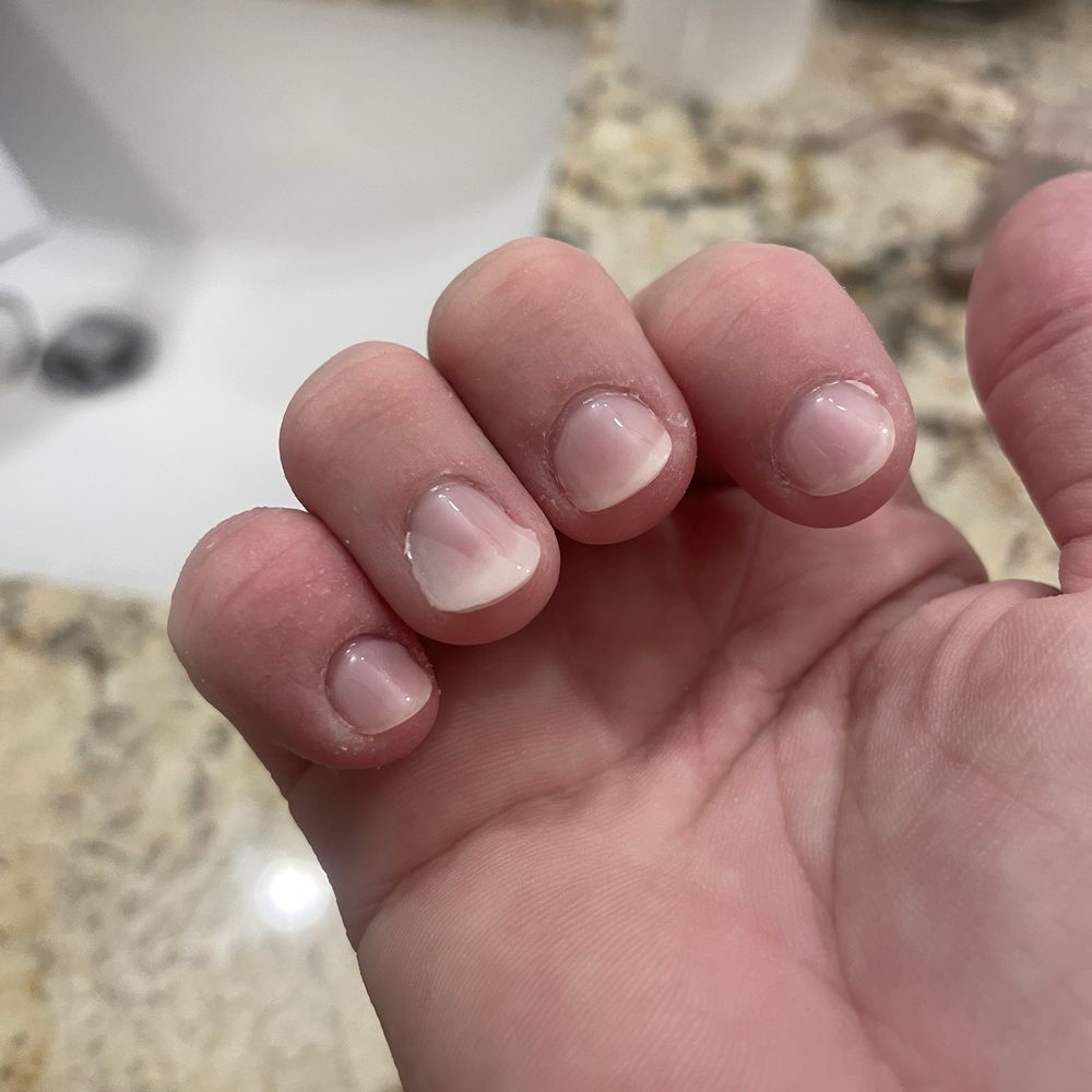 Aura Nail & Spa - Gel polish lifting after just 6 hours & a shower. - Nail Salons Near Me - Houston, Texas