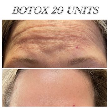 Skinpedia - soften those fine lines to reverse aging looking skin - IV Hydration Near Me - San Francisco, California Skinpedia - soften those fine lines to reverse aging looking skin - IV Hydration Near Me - San Francisco, California