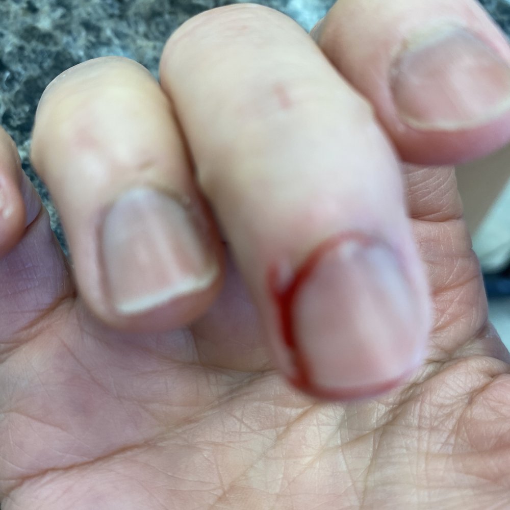 One Hour Nails - I was in serious pain and badly bleeding because the cut was super deep. - Nail Salons Near Me - Temple City, California One Hour Nails - I was in serious pain and badly bleeding because the cut was super deep. - Nail Salons Near Me - Temple City, California