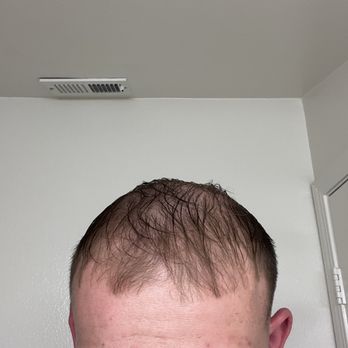 Uni'k Barber Shop - and this is how he left the top of my head - Barbers Near Me - San Diego, California Uni'k Barber Shop - and this is how he left the top of my head - Barbers Near Me - San Diego, California