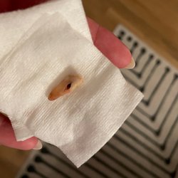 Southern Trinity Health Services - The tooth where he drilled through the middle of a perfectly normal tooth!!!