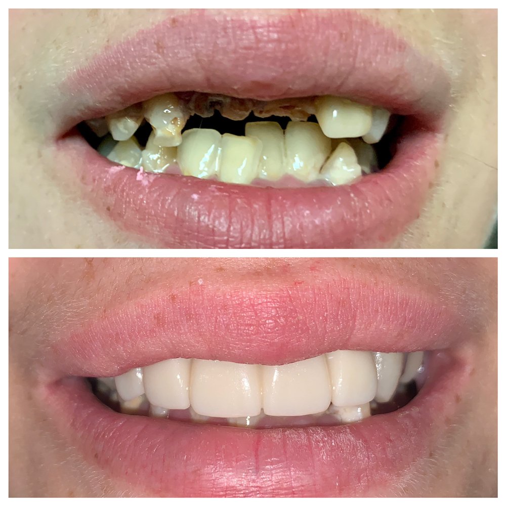 The Best 10 Cosmetic Dentists near Rana Hanna, DMD & Saif Hanna, DMD in  Sterling Heights, MI - Yelp