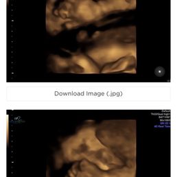 Baby's hand