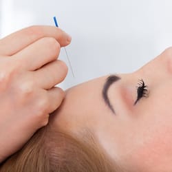 Wholelife Acupuncture & Chinese Medicine Center