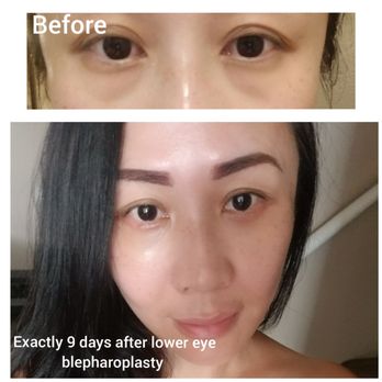 Luan N Nguyen, MD - Plastic Surgeons Near Me - Huntington Beach, California Luan N Nguyen, MD - Plastic Surgeons Near Me - Huntington Beach, California