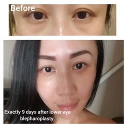 Luan N Nguyen,  MD