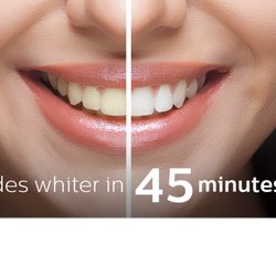 Oasis Dental - Zoom! whitening -- In Office whitening. Have the smile you've always wanted!