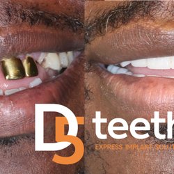 D5teeth - Chicago