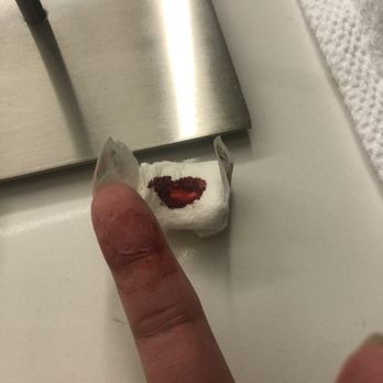 21c Museum Hotel Durham - This is after multiple tissue changes and probably half an hour pressure to stop the bleeding. - Hotels Near Me - Durham, North Carolina
